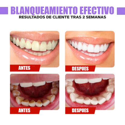 Purple Smile™ - Crema de Dientes Blanqueadora